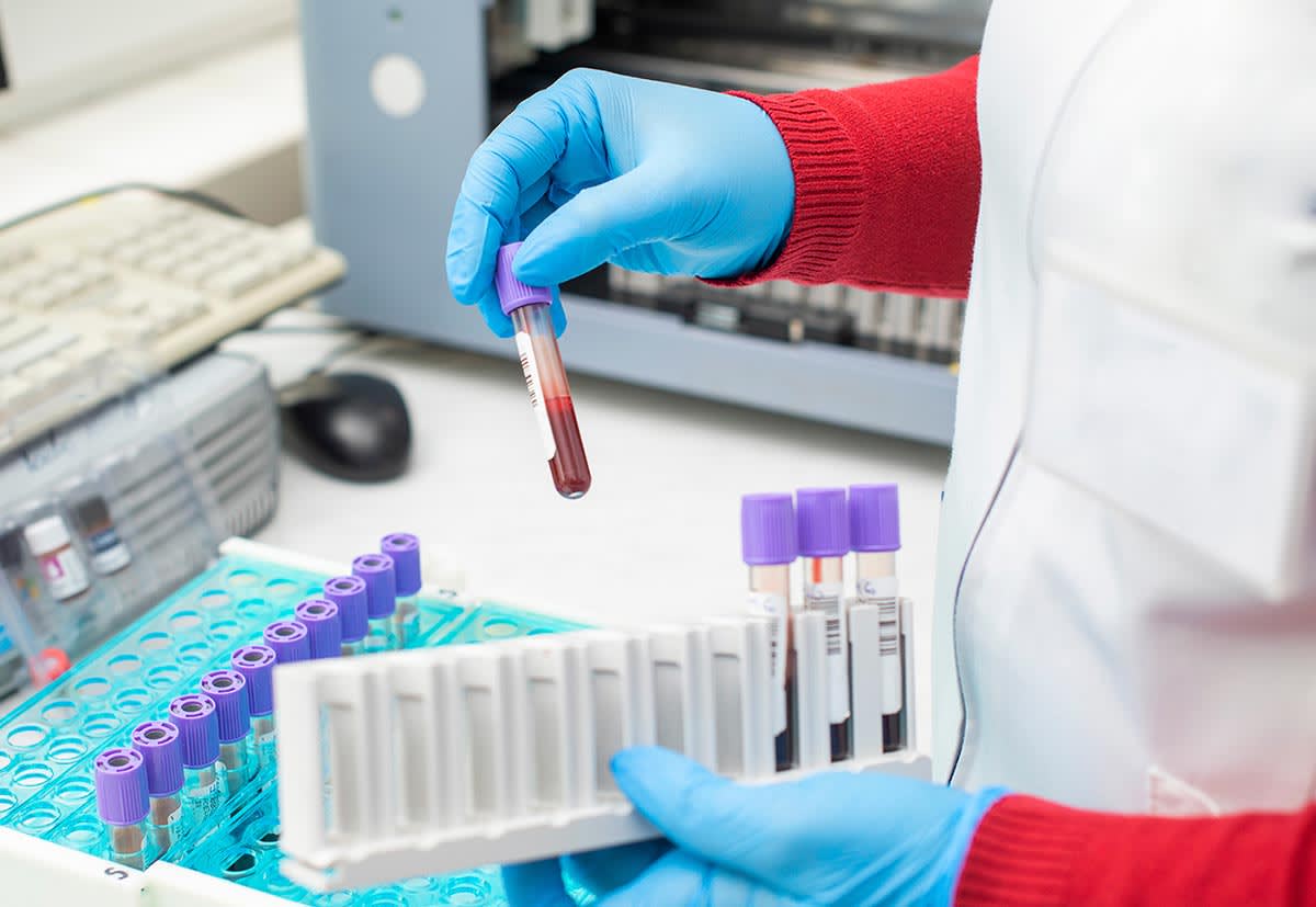 in-vitro